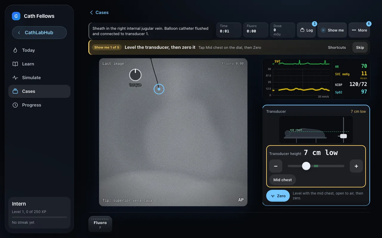 A right heart cath case: the pressure trace and the catheter position